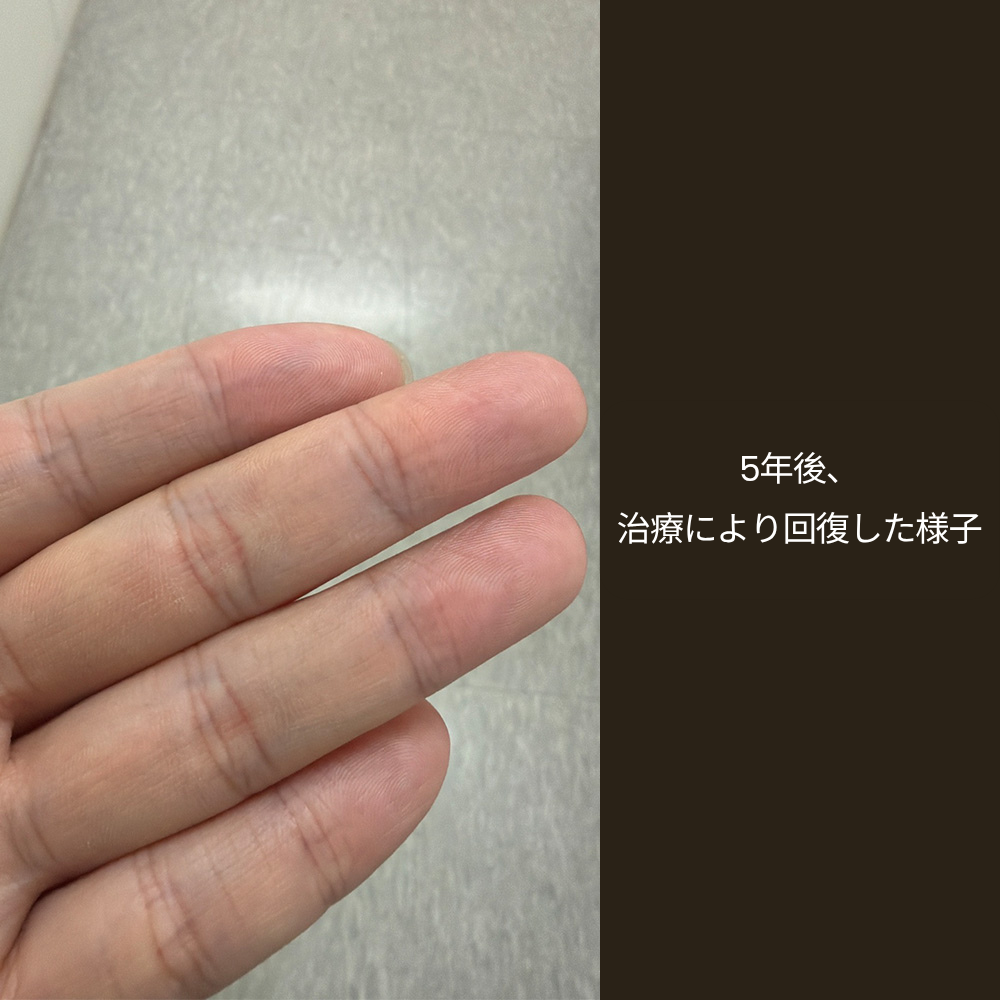 0a89a96d4bd20.png