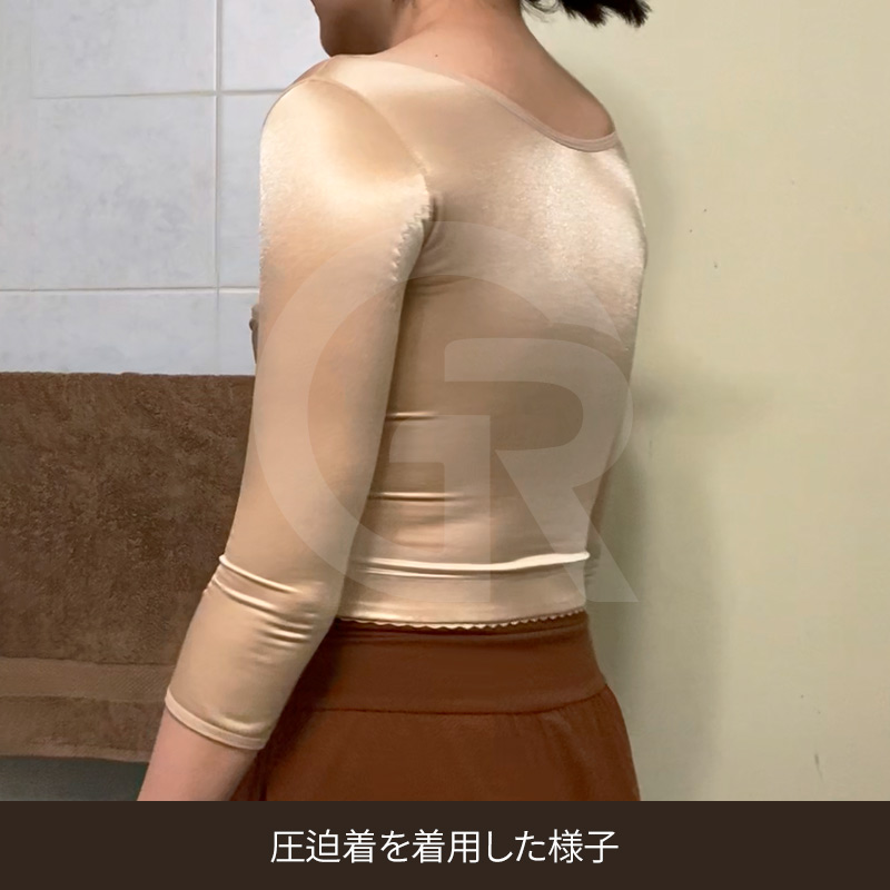 回復過程で感じることのある線維化による硬さ(バイオボンド)