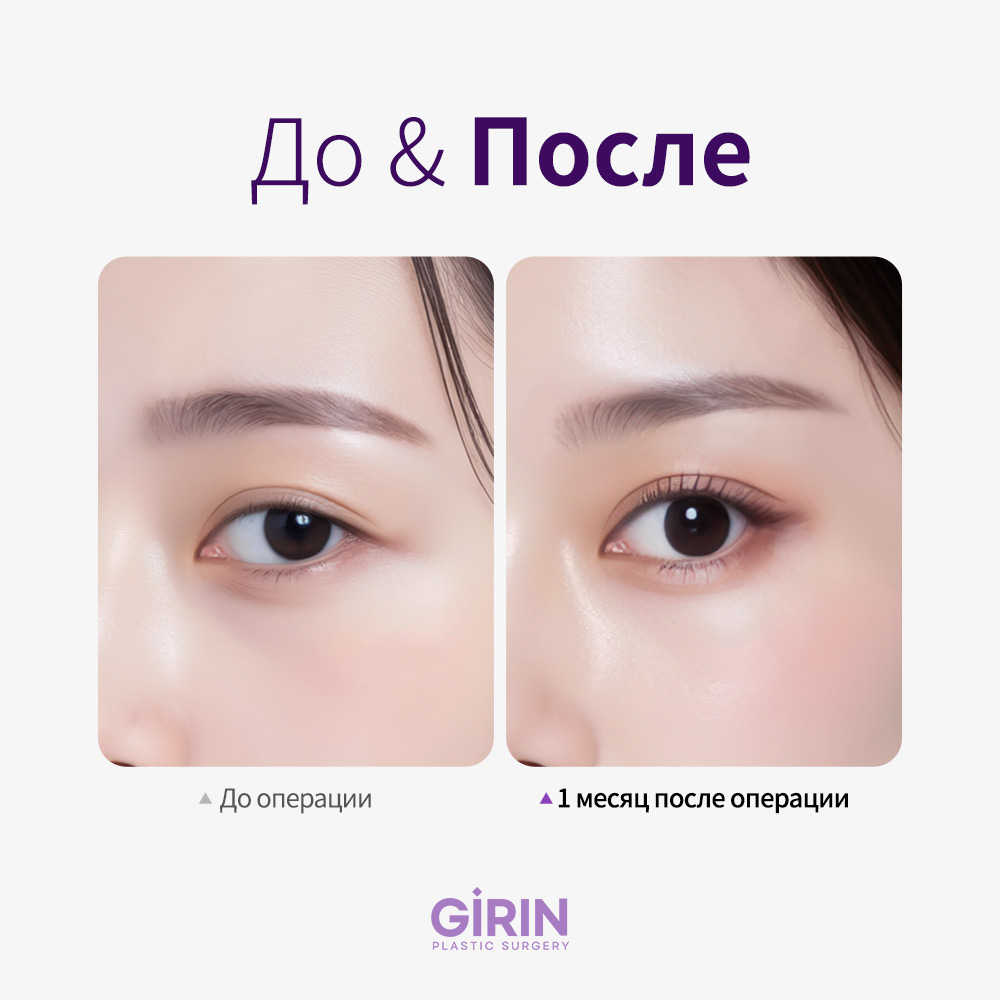 Сравнение «щенячьих» и «кошачьих» глаз. girin-kpop-fox-eye-ru-05.jpg