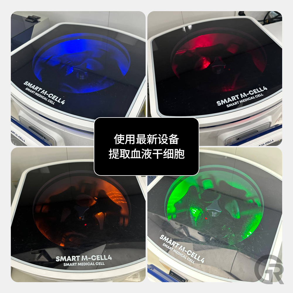 毛发逐渐变细的微小化现象