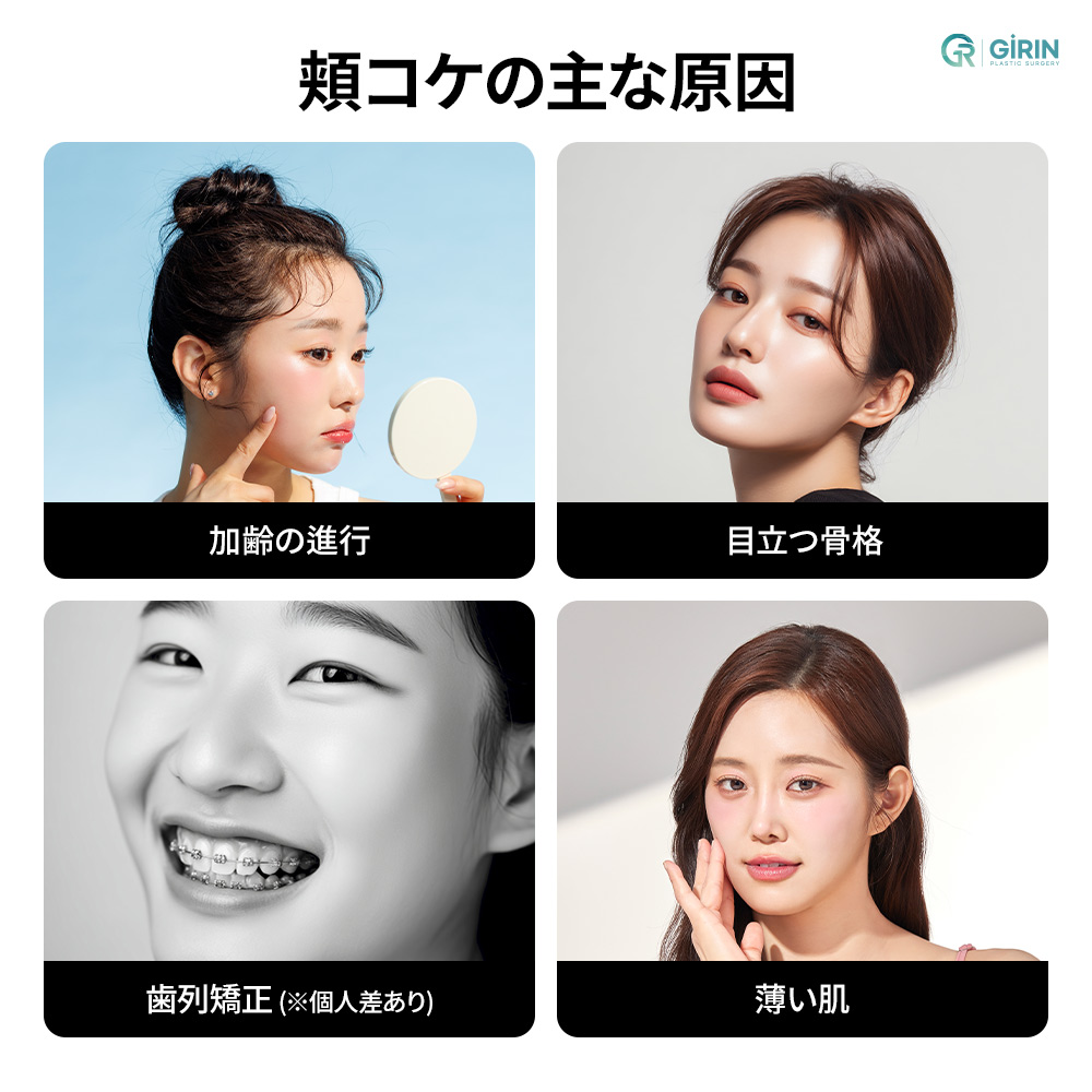 写真で強調されやすい頬コケ印象、立体バランスでやわらげる発想。