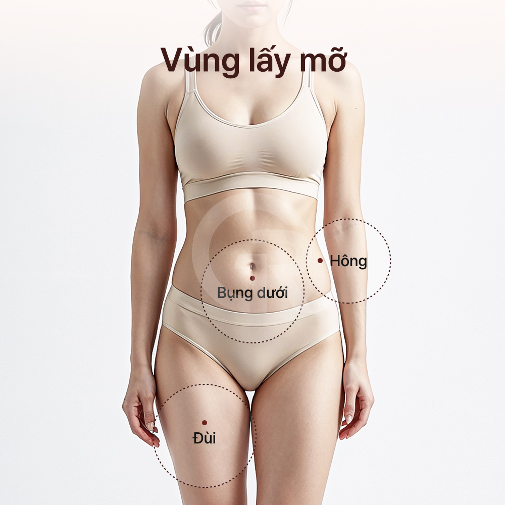 Cấy mỡ vi mô phù hợp với khuôn mặt bị lõm hoặc hóp do mất thể tích tự nhiên.
