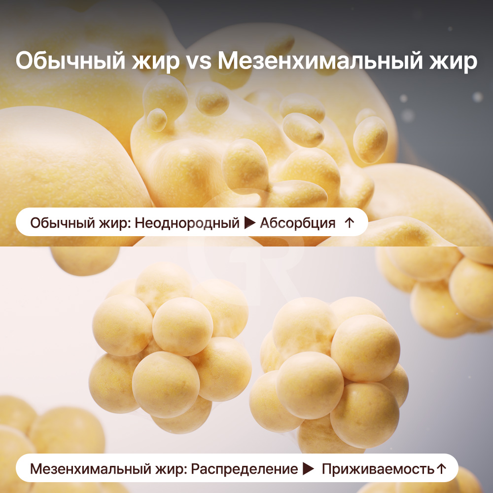 Чем быстрее формируются новые кровеносные сосуды, тем выше вероятность, что пересаженный жир получит кислород и питание.