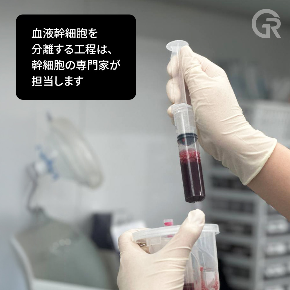 PRPと幹細胞治療の比較説明