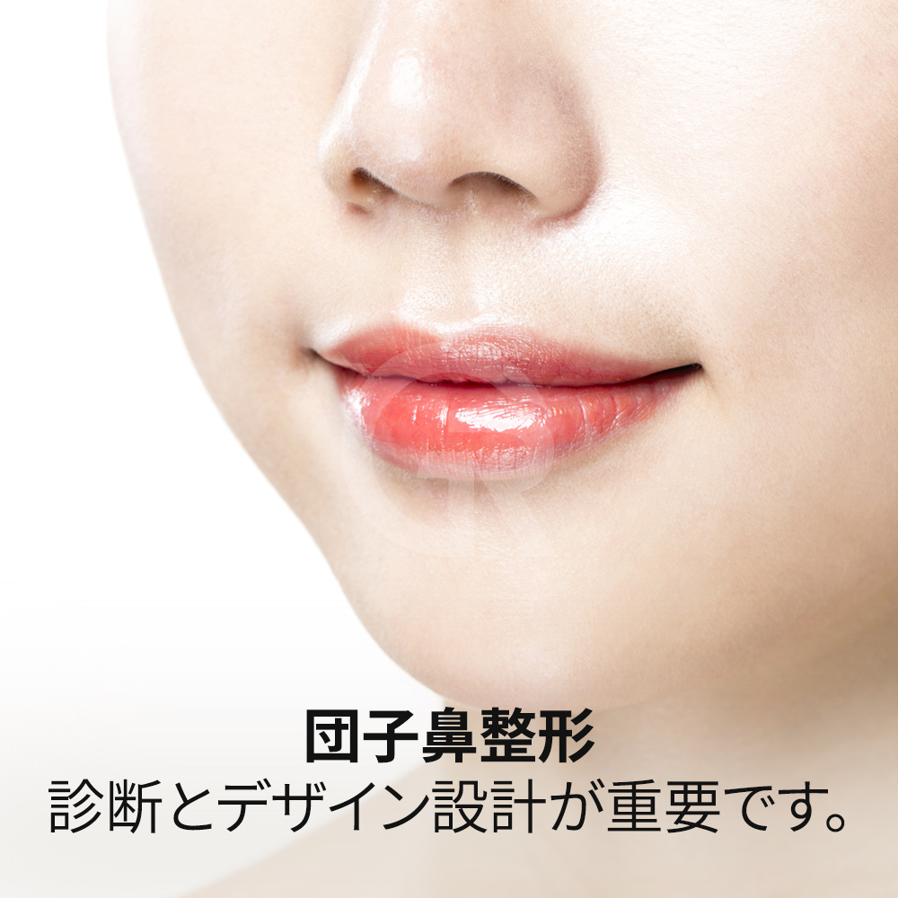 細く見える鼻先は、患者様一人ひとりの鼻の構造に合わせてデザインすることが大切です。