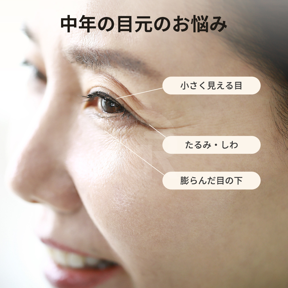 中年になると、まぶたと眉の下垂によって目が小さく重く見えることがあります。