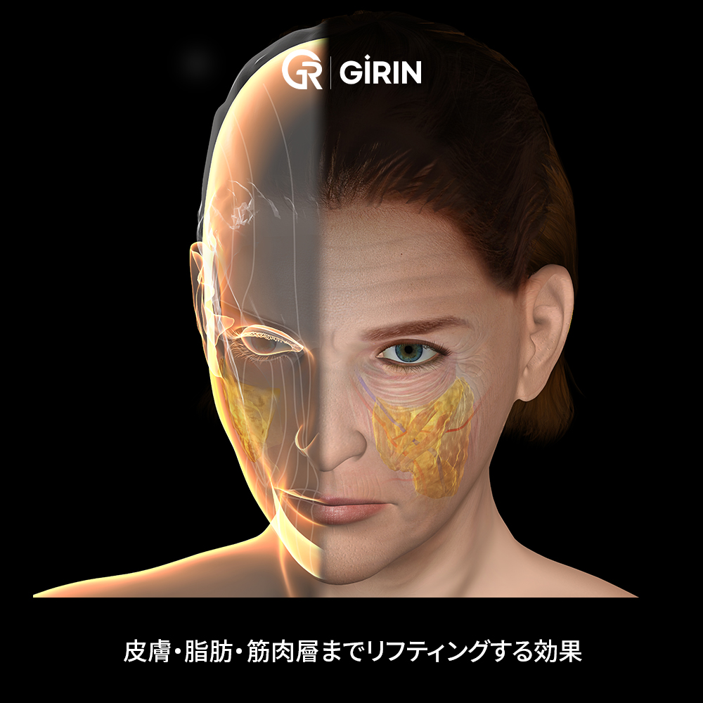 フェイスラインと首のたるみ改善