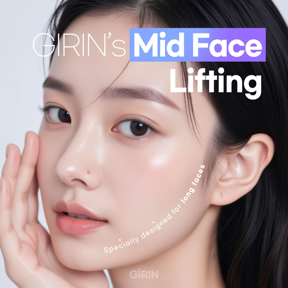 Midface thread lift in Korea before and after results