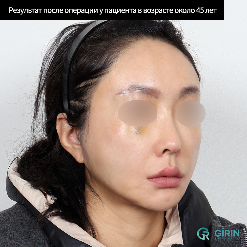 Естественный результат без эффекта маски