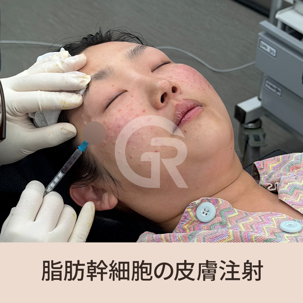 問題の本質は髪そのものではなく、髪を育てる土台である頭皮環境にあるという視点が重要です