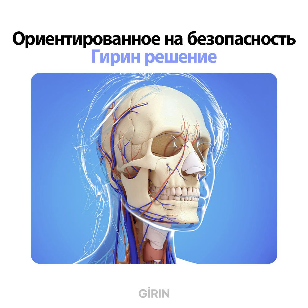 Схема нитевого лифтинга средней зоны лица в Корее