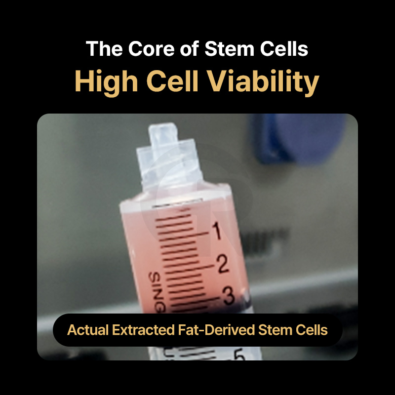 Stem cell therapy may be used to complement recovery environments following breast surgery involving significant tissue changes.