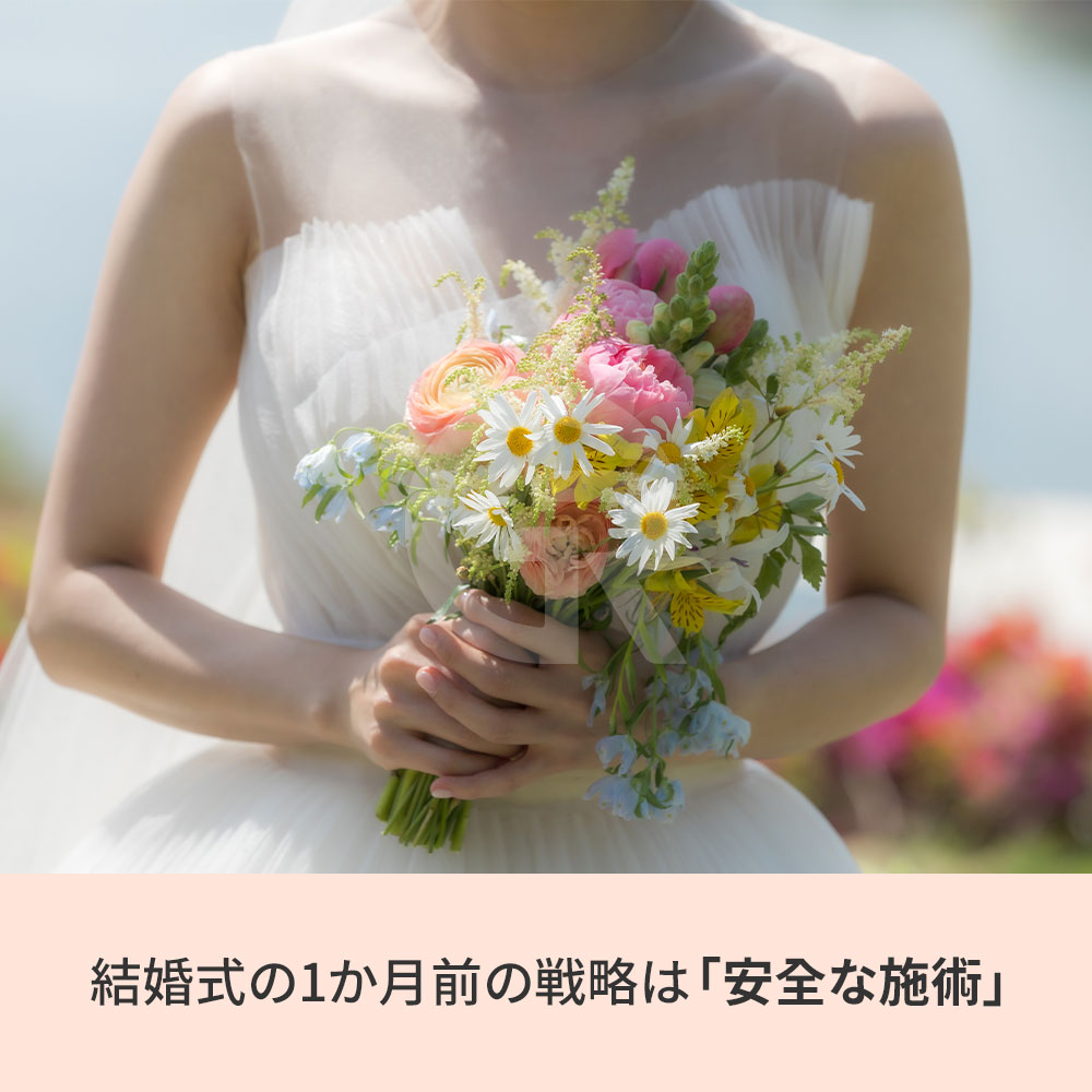低刺激レーザー治療は、肌のきめを整え、結婚式当日のメイク密着度を高めるのに役立ちます。