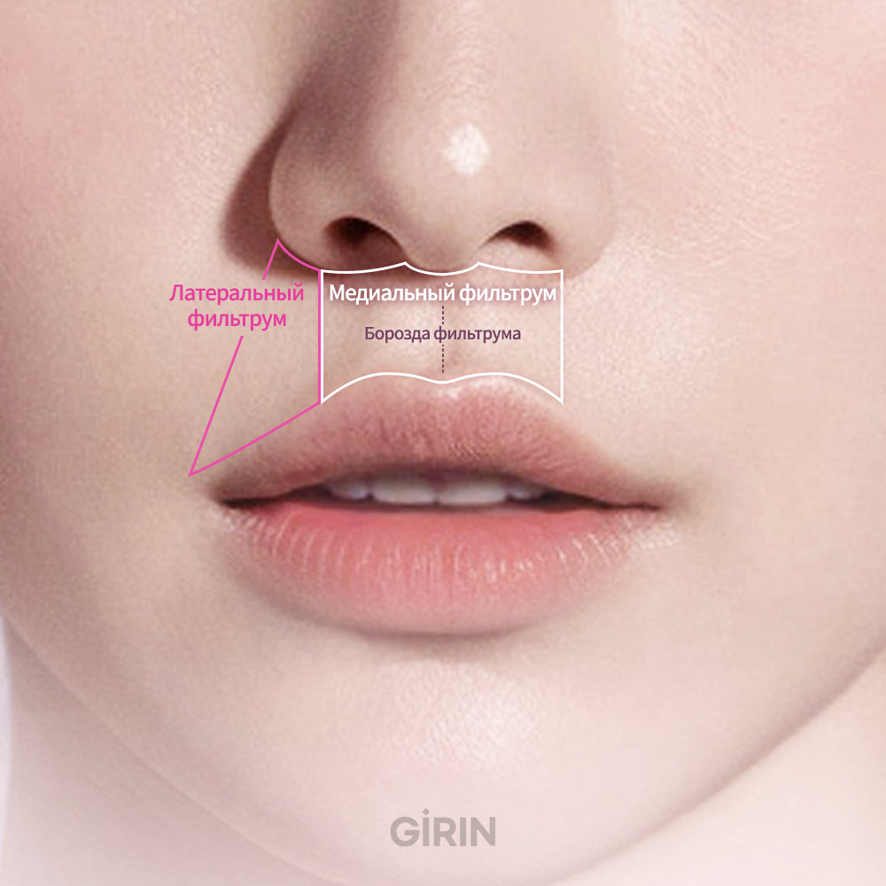 Причины удлинения фильтрума из-за старения и потери эластичности