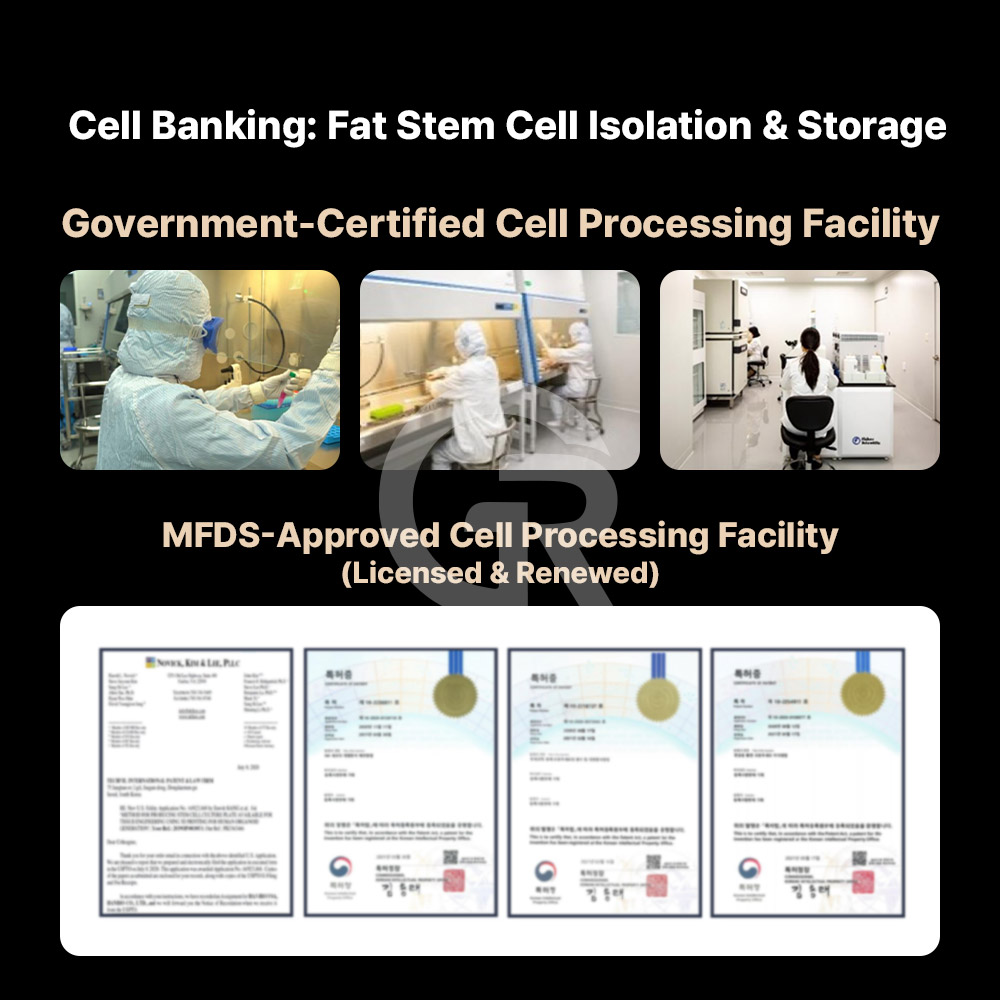 Minimally invasive liposuction allows efficient harvesting of adipose-derived stem cells.