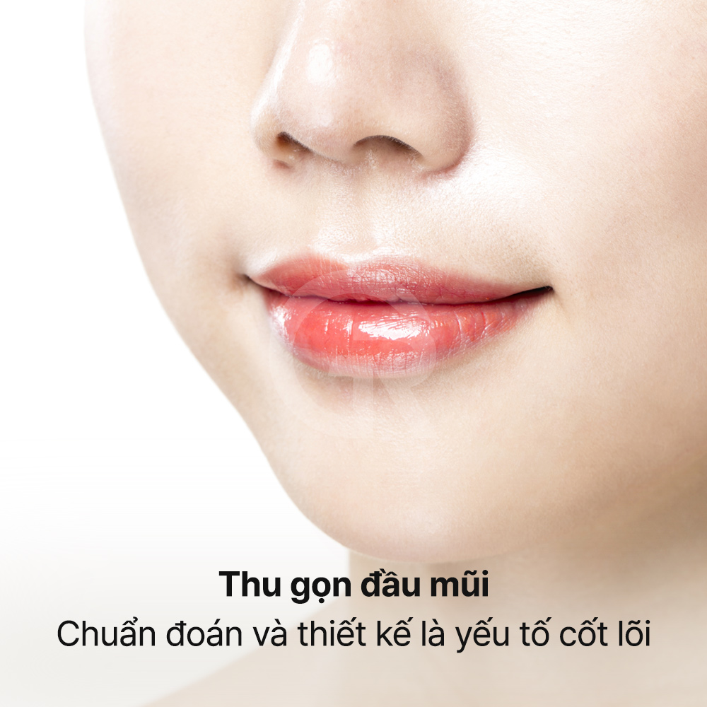 Đầu mũi thon gọn hơn có thể được thiết kế dựa trên cấu trúc mũi vốn có của từng bệnh nhân.