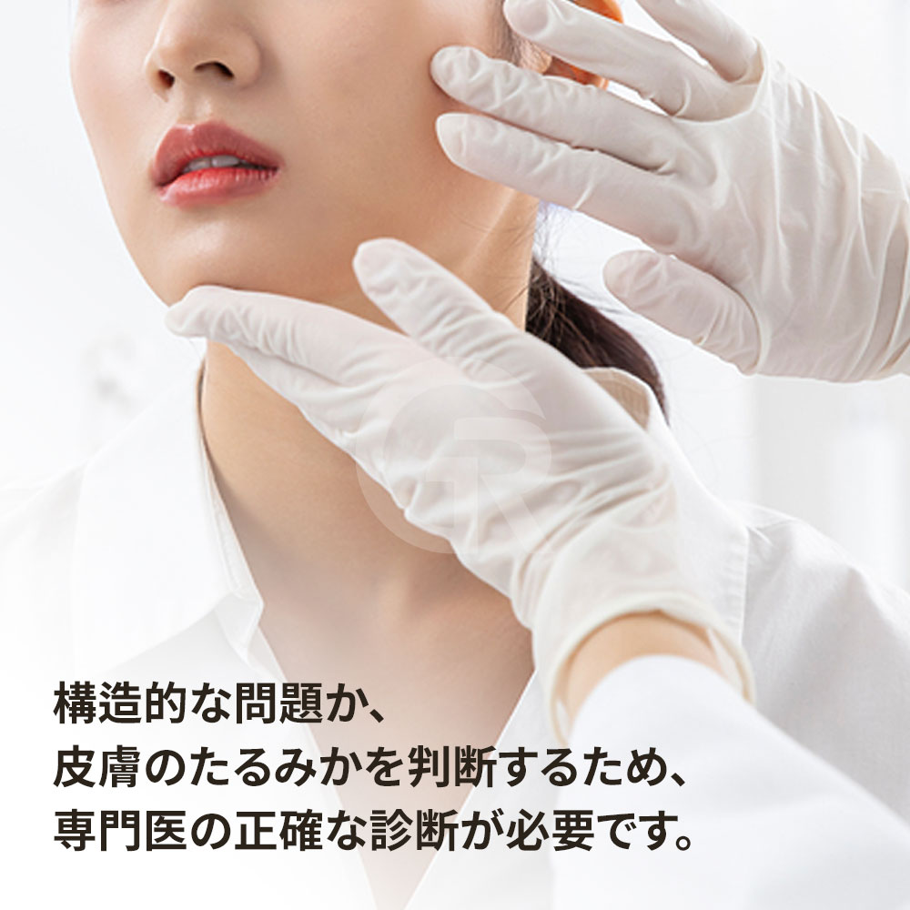 ほうれい線は単なるシワではなく、頬や口元の組織のたるみと関係している場合があります