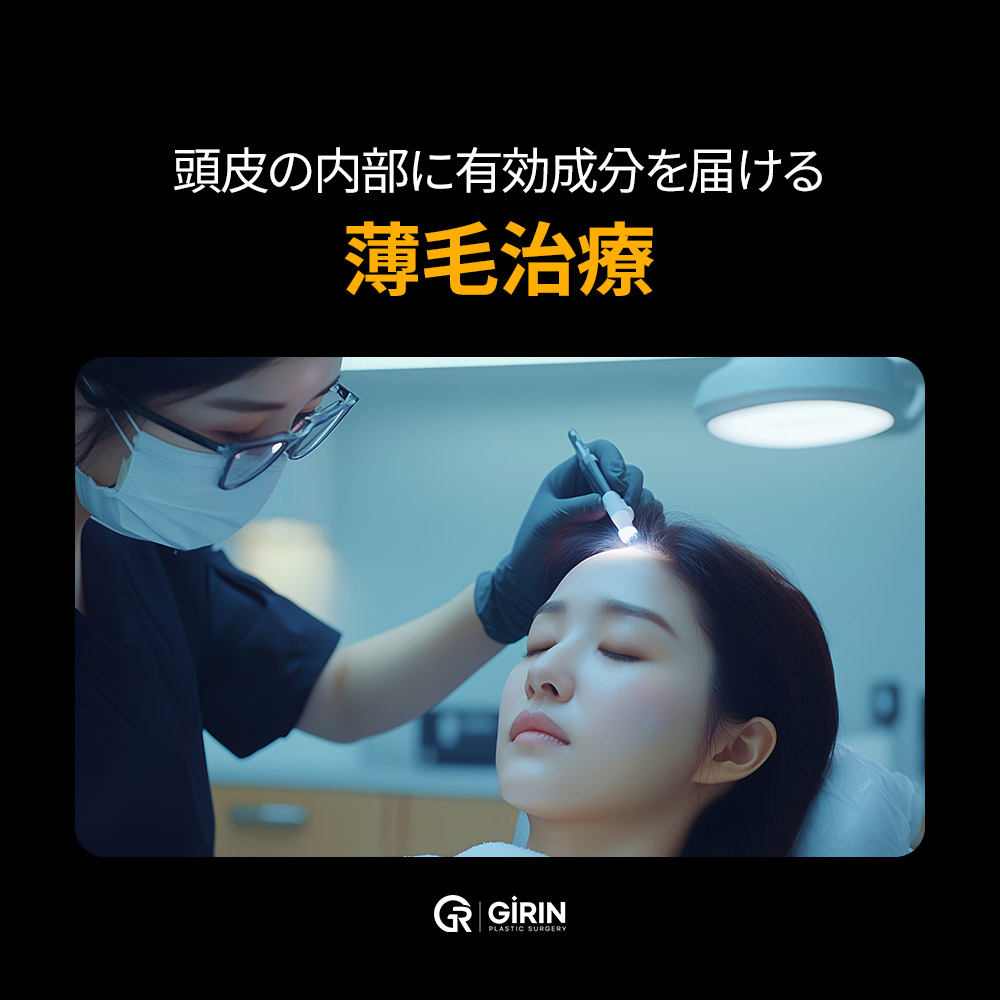 ソウル・ギリン美容外科のMinoxcellによる外科手術なしの幹細胞薄毛治療。