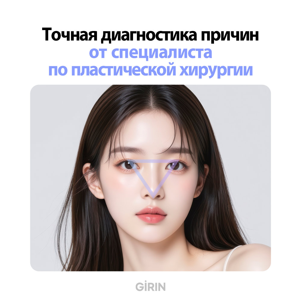 Подтяжка лица без операции нитями в Корее