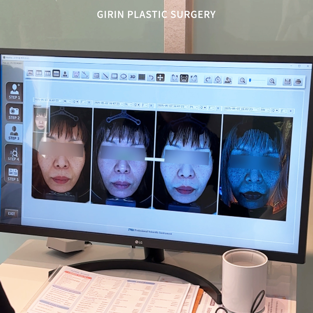 Лифтинг в Сеуле