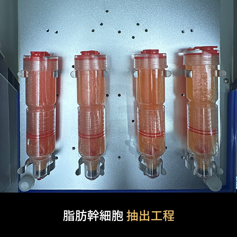 なぜ韓国では、幹細胞注射に血液ではなく脂肪が用いられることがあるのか。