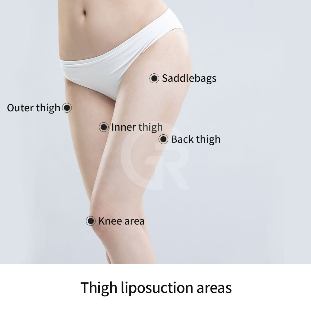 Even if your body weight is within the standard range, localized thigh fat can affect the overall body line.