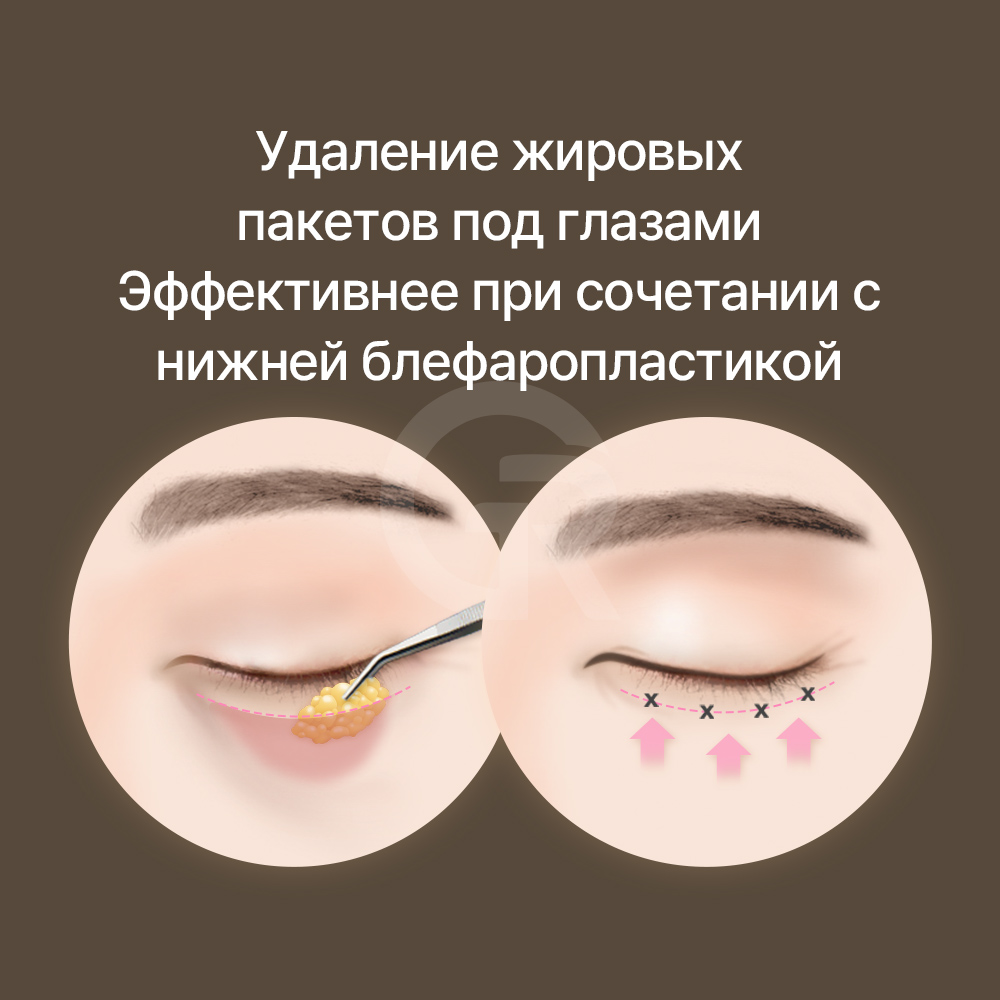 Простое поднятие бровей руками может помочь определить причину проблемы.