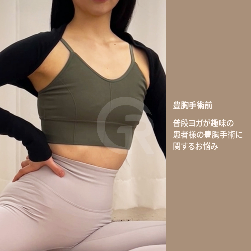 豊胸手術の前には、胸郭の幅や乳房基底幅など体型全体のバランスを分析するカウンセリングが重要になります。