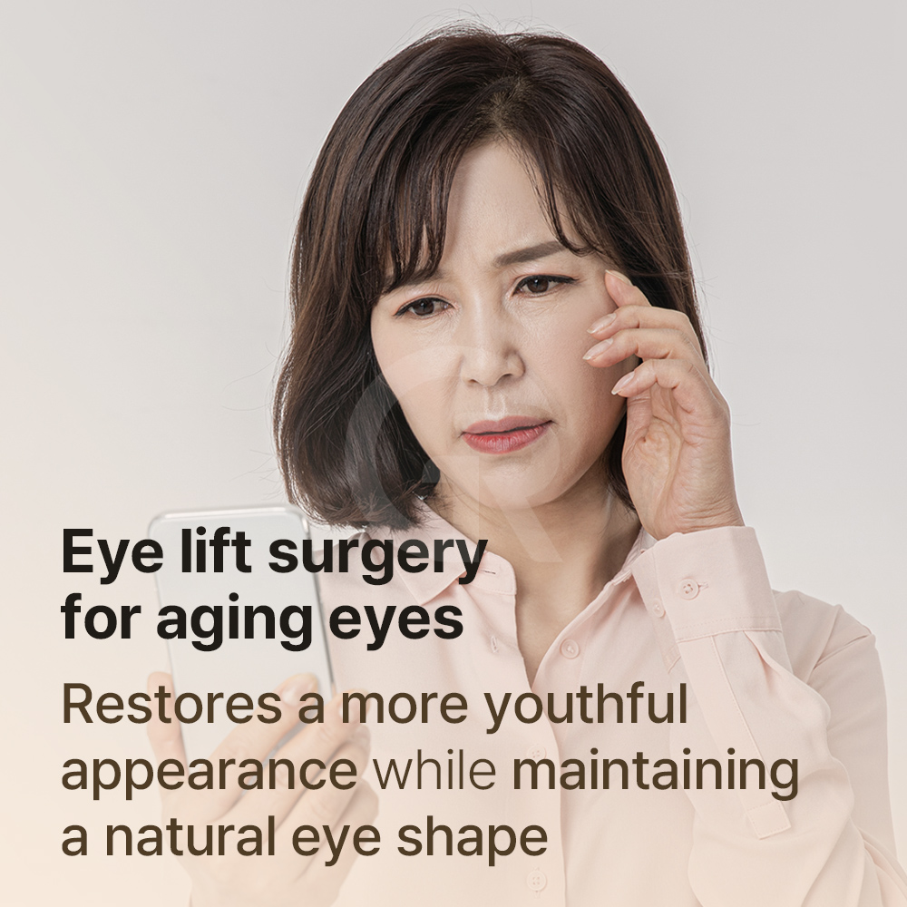 Lower blepharoplasty improves both sagging skin and muscle laxity for a refreshed look.