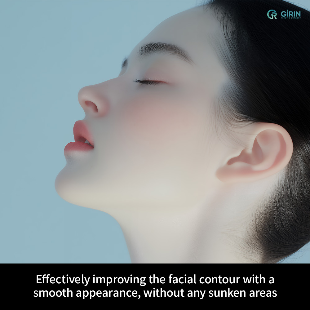 This image shows an actual filler treatment result without any photo retouching.