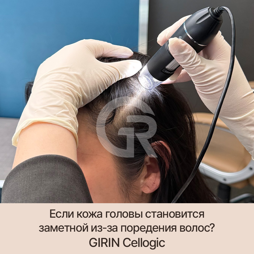 Шампунь не помогает? Возможно, проблема в состоянии кожи головы