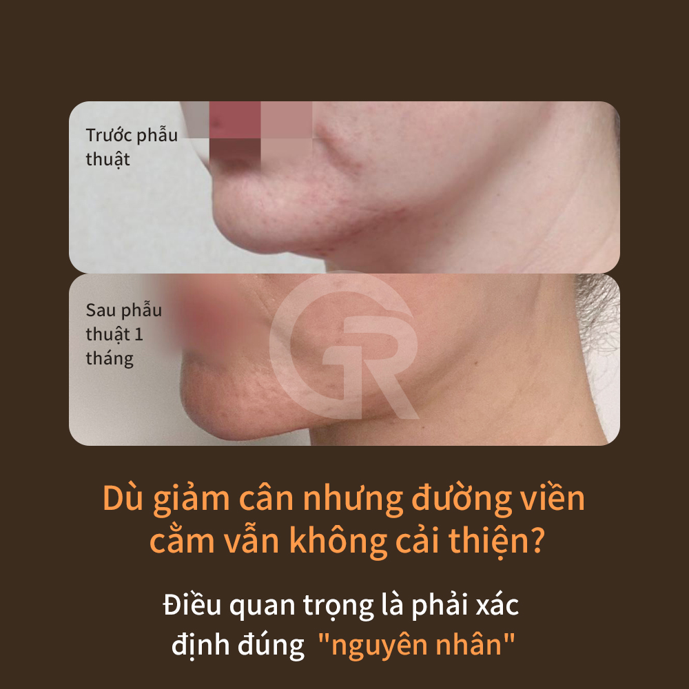 455f7048c46fd.png