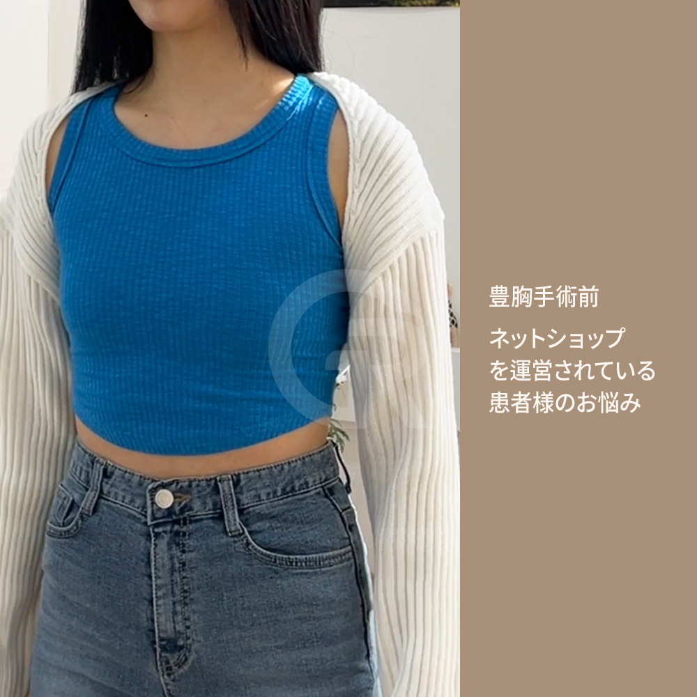 韓国の豊胸手術では、自然な乳房の形と体のプロポーションを重視した手術計画が行われます。