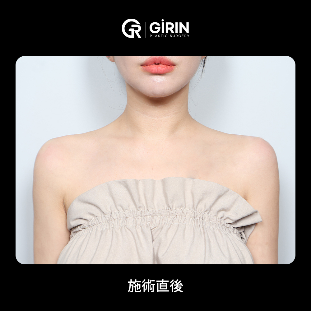 施術時間20分、自然な変化を実現