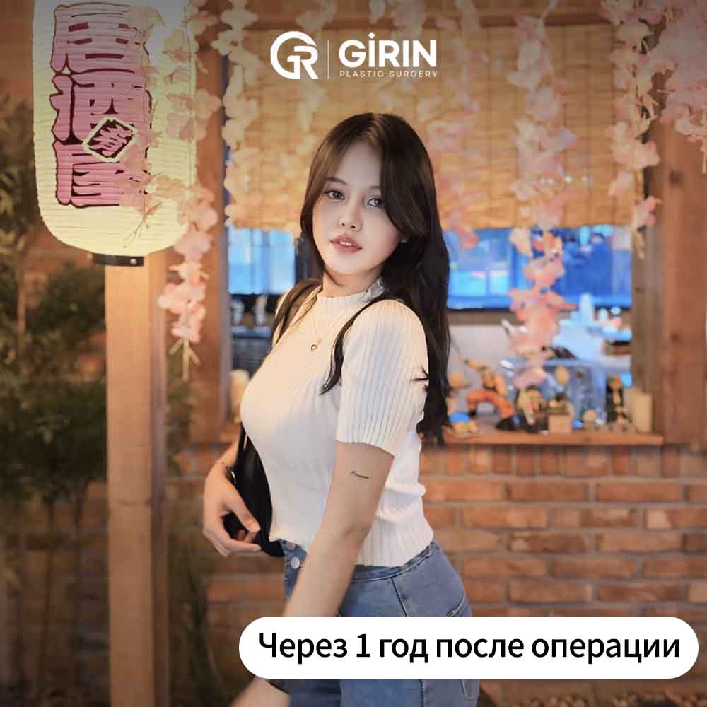 Лучшая пластическая хирургия рук в Сеуле, Корея