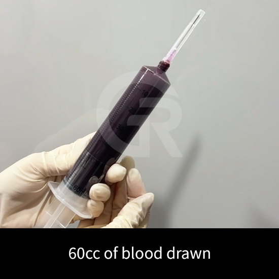 Treatment planning for thin skin focuses on long-term structural stability.