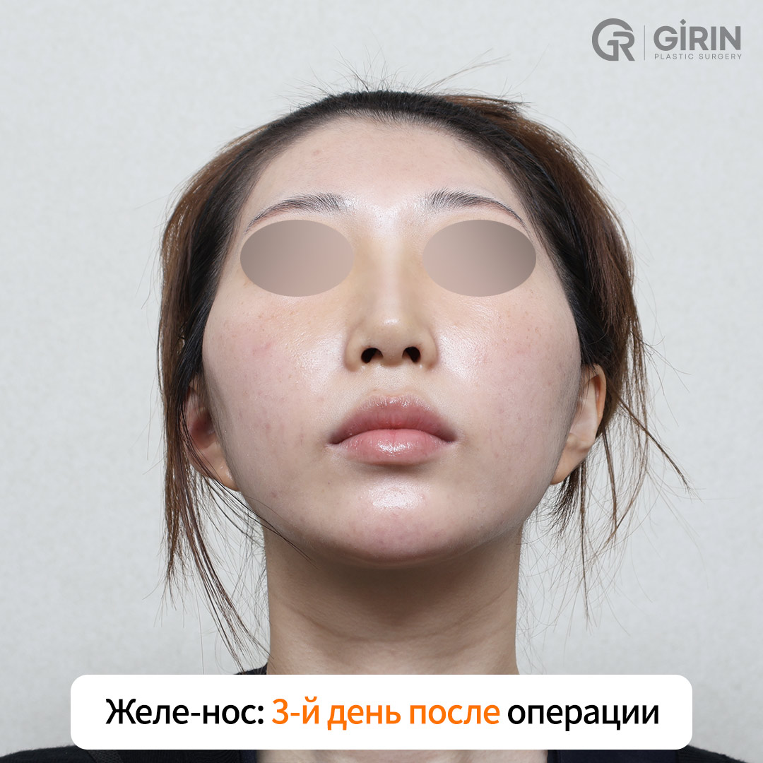 Пациентка вернулась к работе через три дня после операции