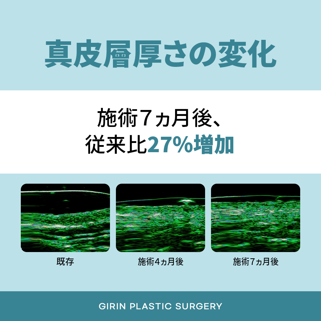 レディエッセ ビフォーアフター