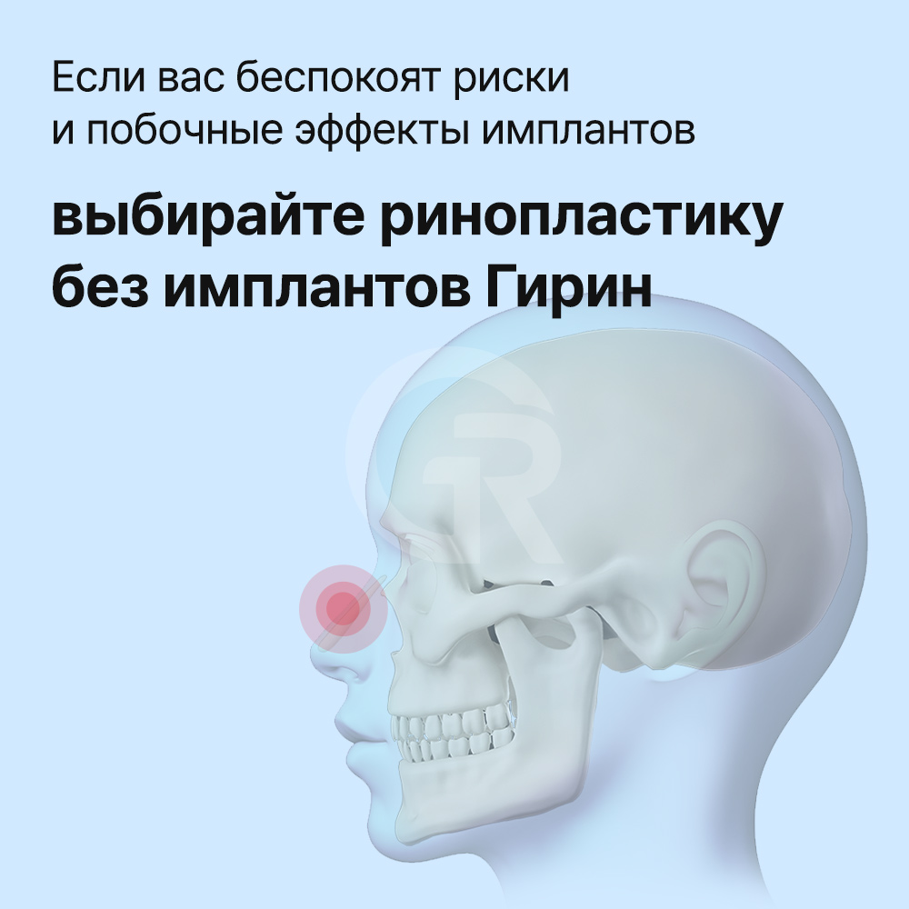 Закрытая ринопластика позволяет корректировать мясистый нос через разрезы внутри ноздрей без видимого внешнего рубца.