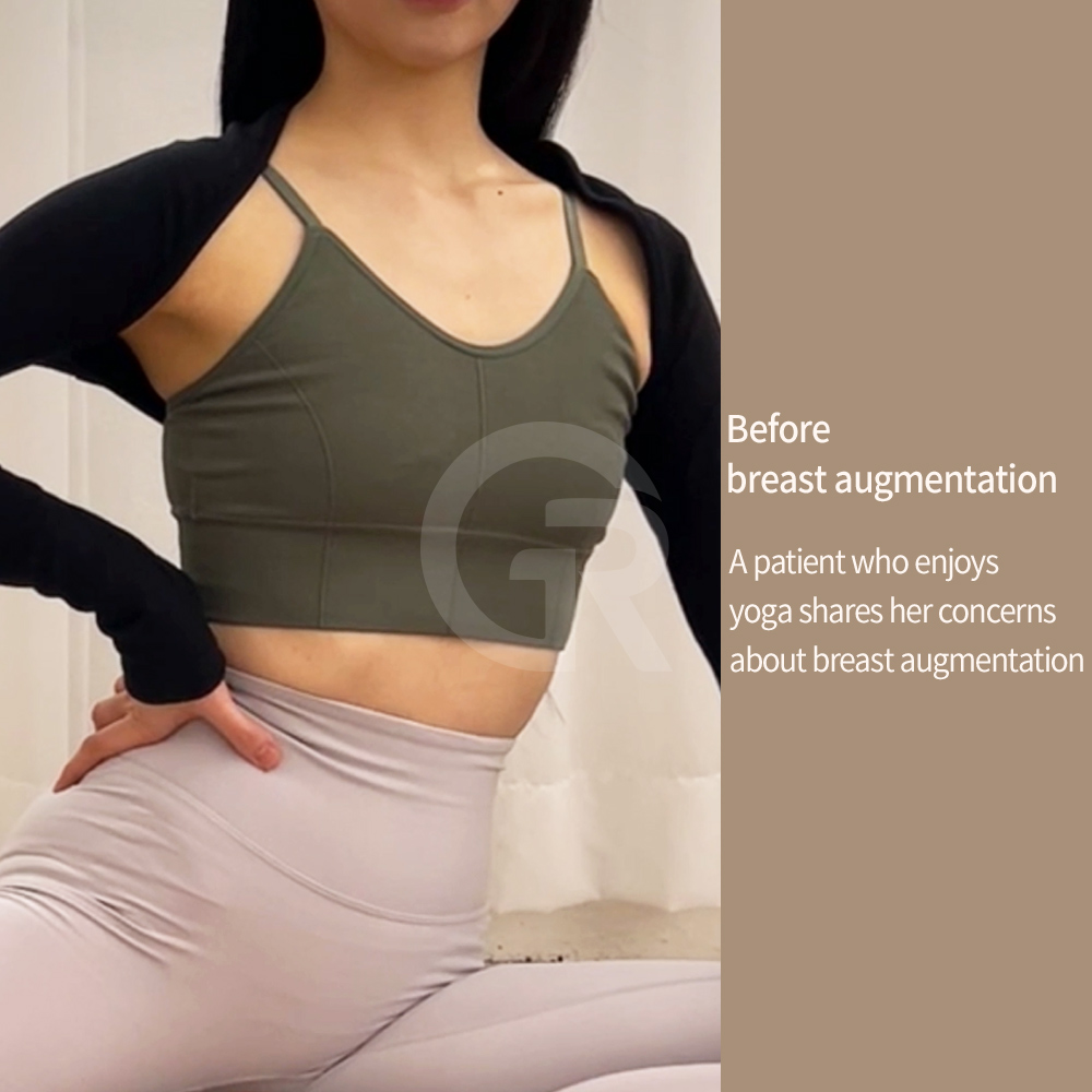 A consultation for breast augmentation in Korea often includes a detailed analysis of chest width, breast base, and skin thickness.