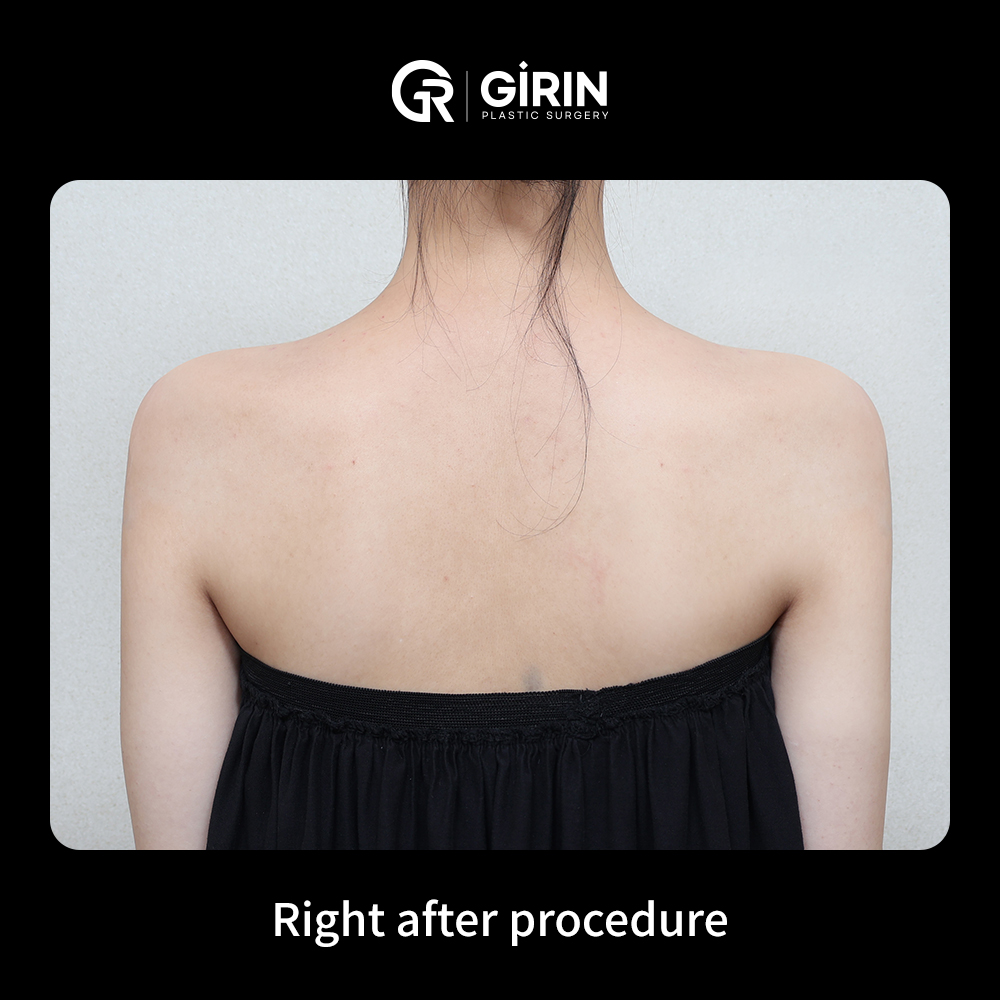 Sunday consultations available at Gangnam’s top shoulder clinic