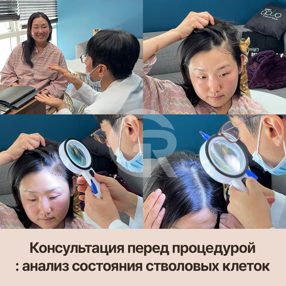 Расширяющийся пробор может быть самым ранним признаком начала выпадения волос