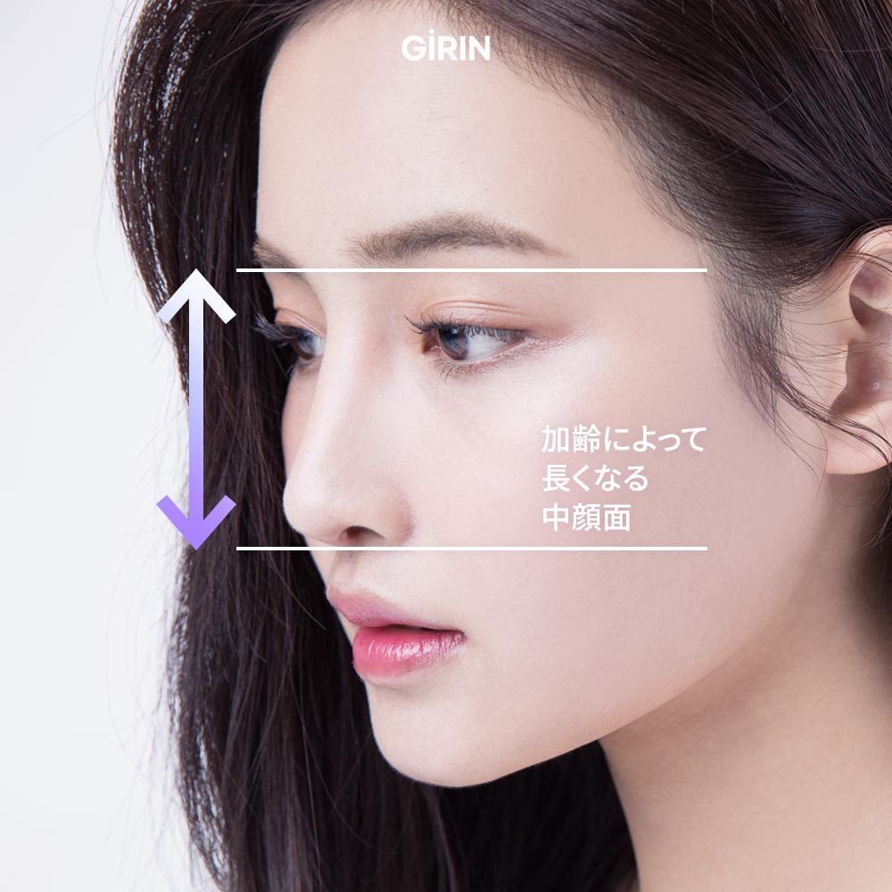 ミッドフェイス スレッドリフトとは何かを説明する図解