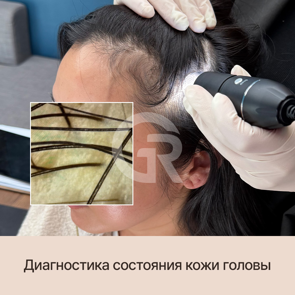 Если кажется, что волосы растут хуже, возможно, цикл роста уже нарушен