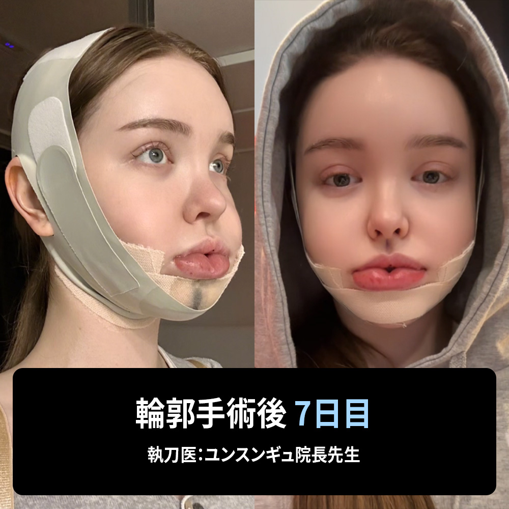 自然な調和を重視した輪郭整形アプローチ。