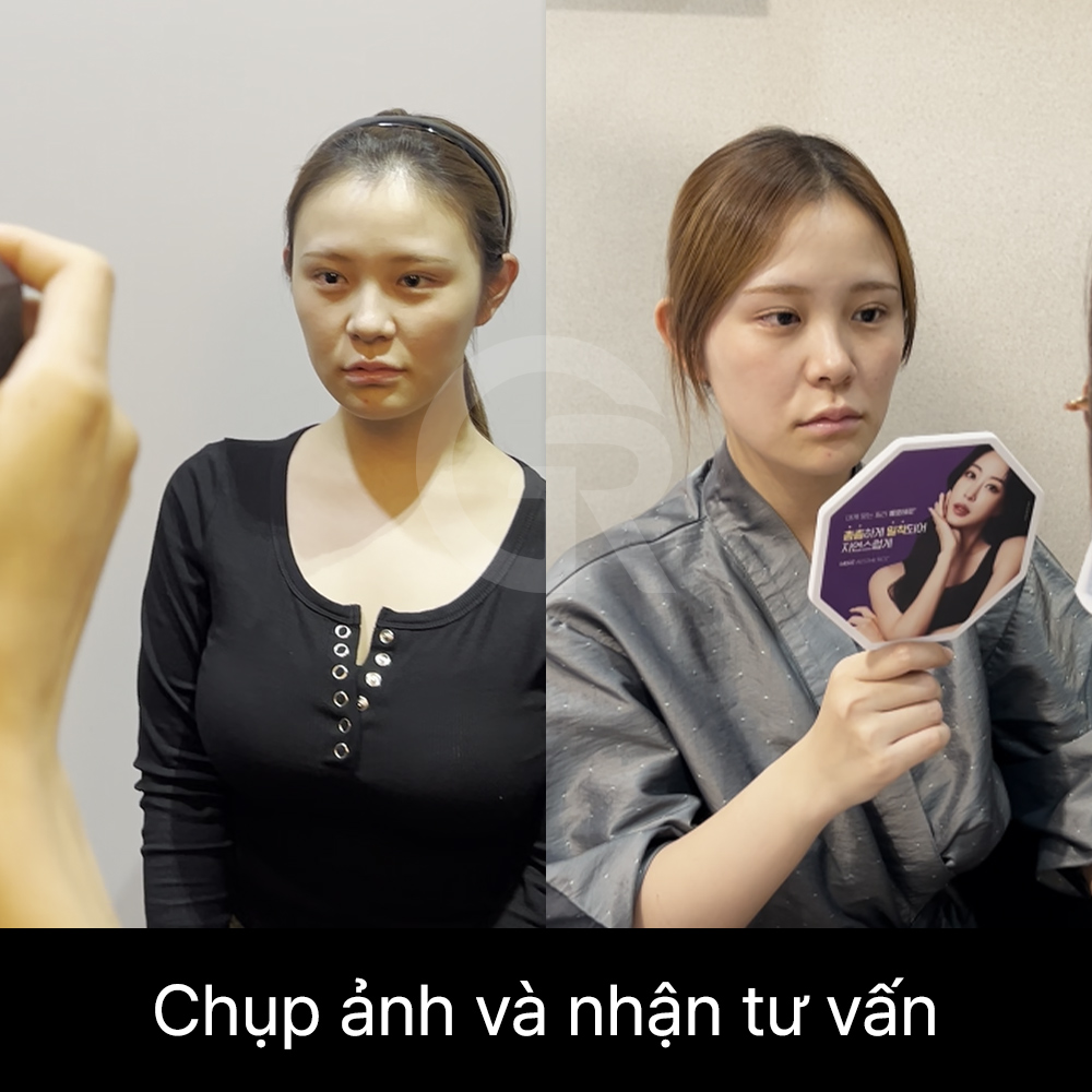 Với mũi đầu to hoặc mũi ngắn, hướng đầu mũi, trụ mũi và mức độ lộ lỗ mũi cần được đánh giá cùng nhau.