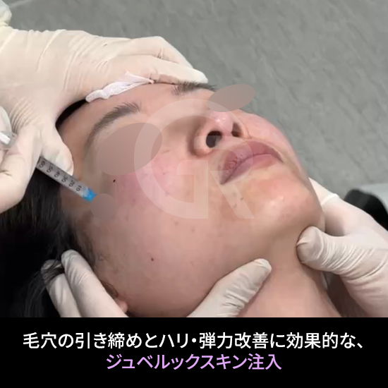 造血幹細胞（HSC）は、肌回復環境をサポートする役割を果たします。