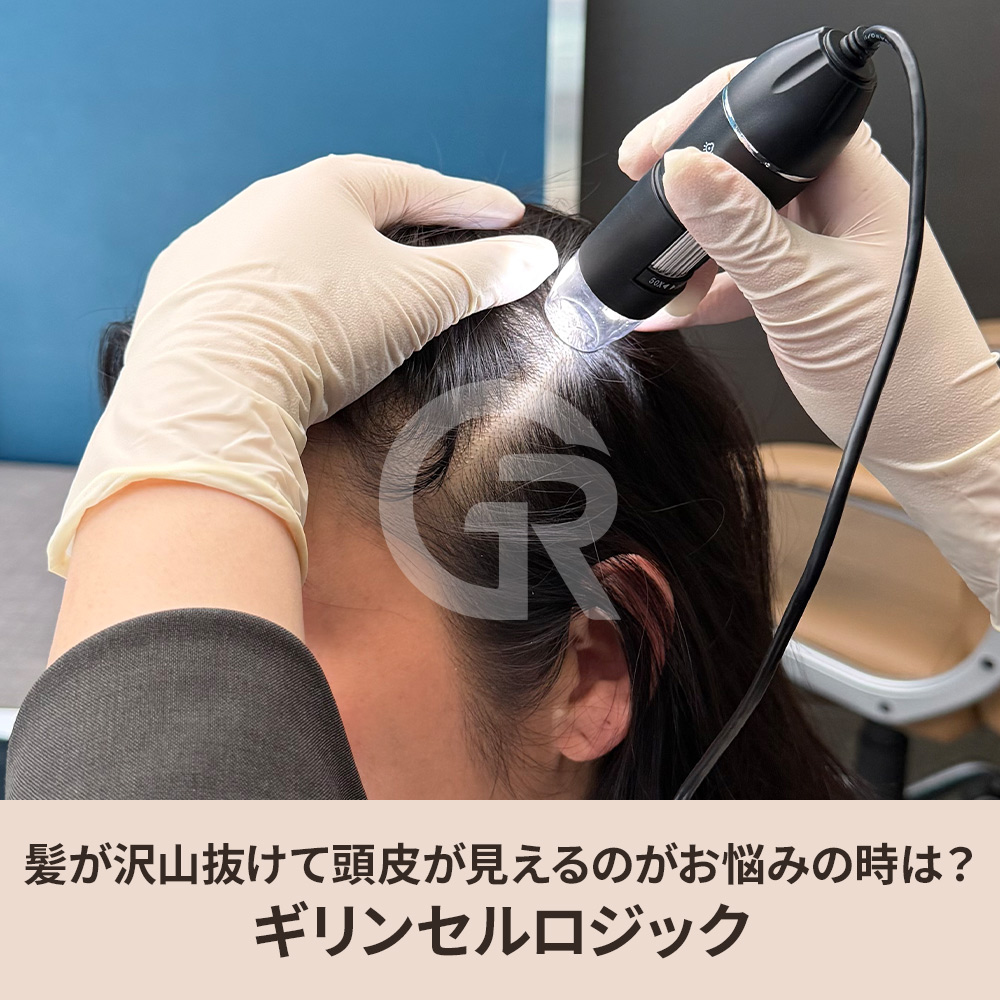 髪が細くなり全体のボリュームが減ってきたと感じるとき、その原因は髪そのものではなく頭皮環境の変化にあるかもしれません