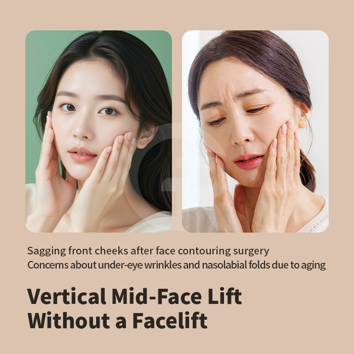 A lower eyelid approach enables repositioning of the under-eye and cheek area within the same anatomical plane.