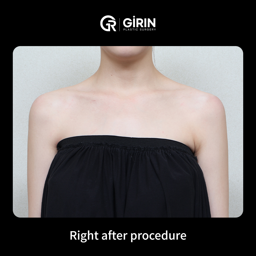 Safe filler injections based on anatomy by certified surgeons